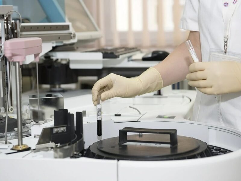Comprendre le fonctionnement d&rsquo;un transducteur ultrason